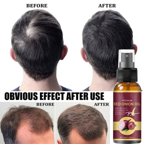 Hair Growth Serum Spray